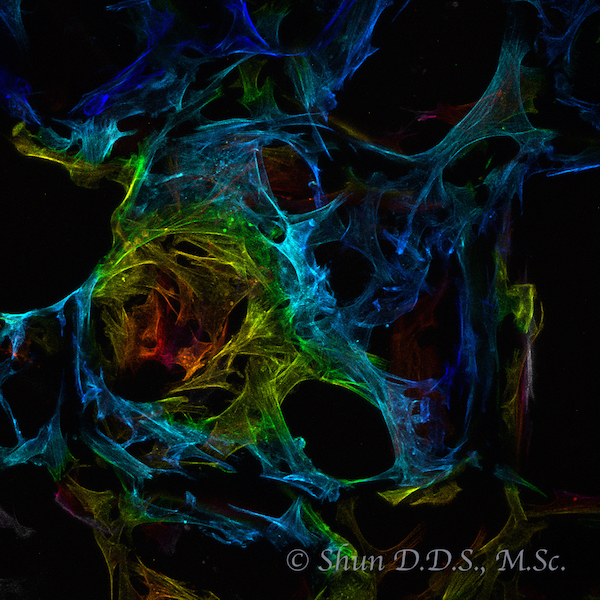 3Dスキャフォールドと幹細胞